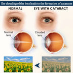 QIAWI® Potent Vision Support Eye Patch👁️✨